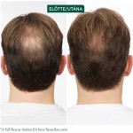 Matrix Biolage Full Rescue Aminexil hajhullás elleni regeneráló ampulla,10x6 ml 